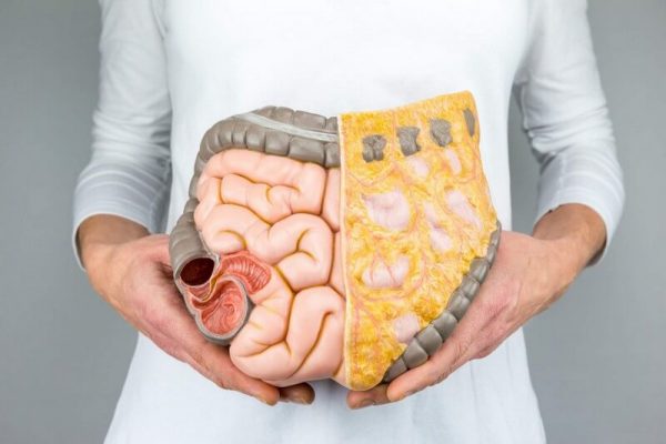 Crohn's disease: ulcerative colitis
